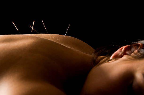 The dry needling method is an innovative therapeutic massageThe dry needling method – innovative therapeutic massage, Photo 1183